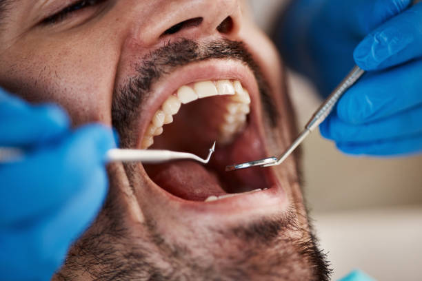 Best Same-Day Emergency Dental Services in Eufaula, OK